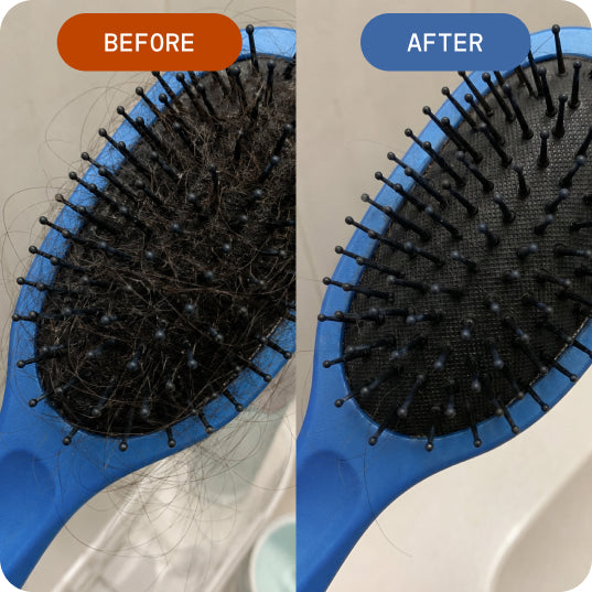 Less thinning on your head. Less growth everywhere else