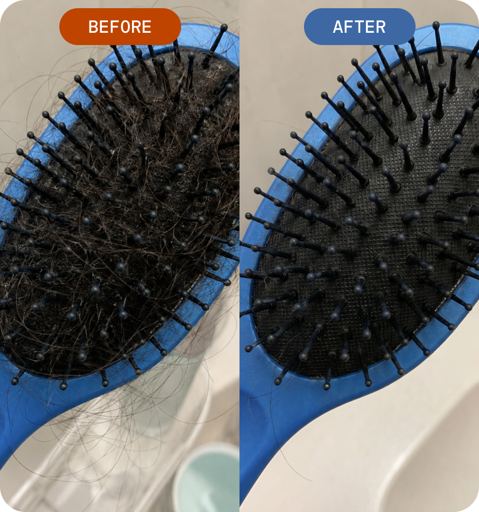 Less thinning on your head. Less growth everywhere else
