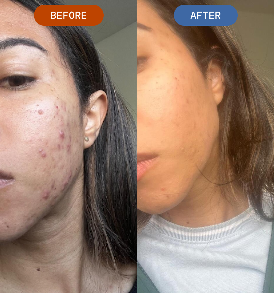 Skin that clears without changing your entire routine