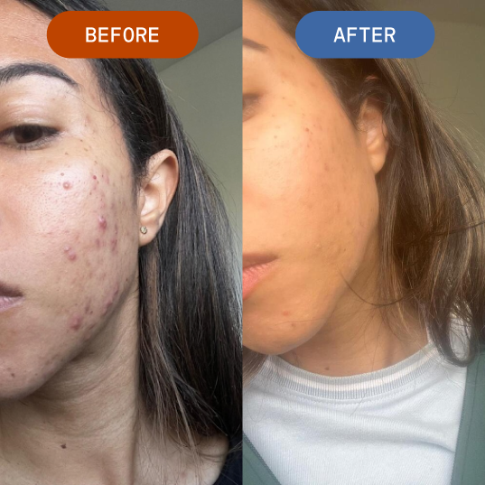 Skin that clears without changing your entire routine